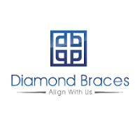 Diamond Braces image 3